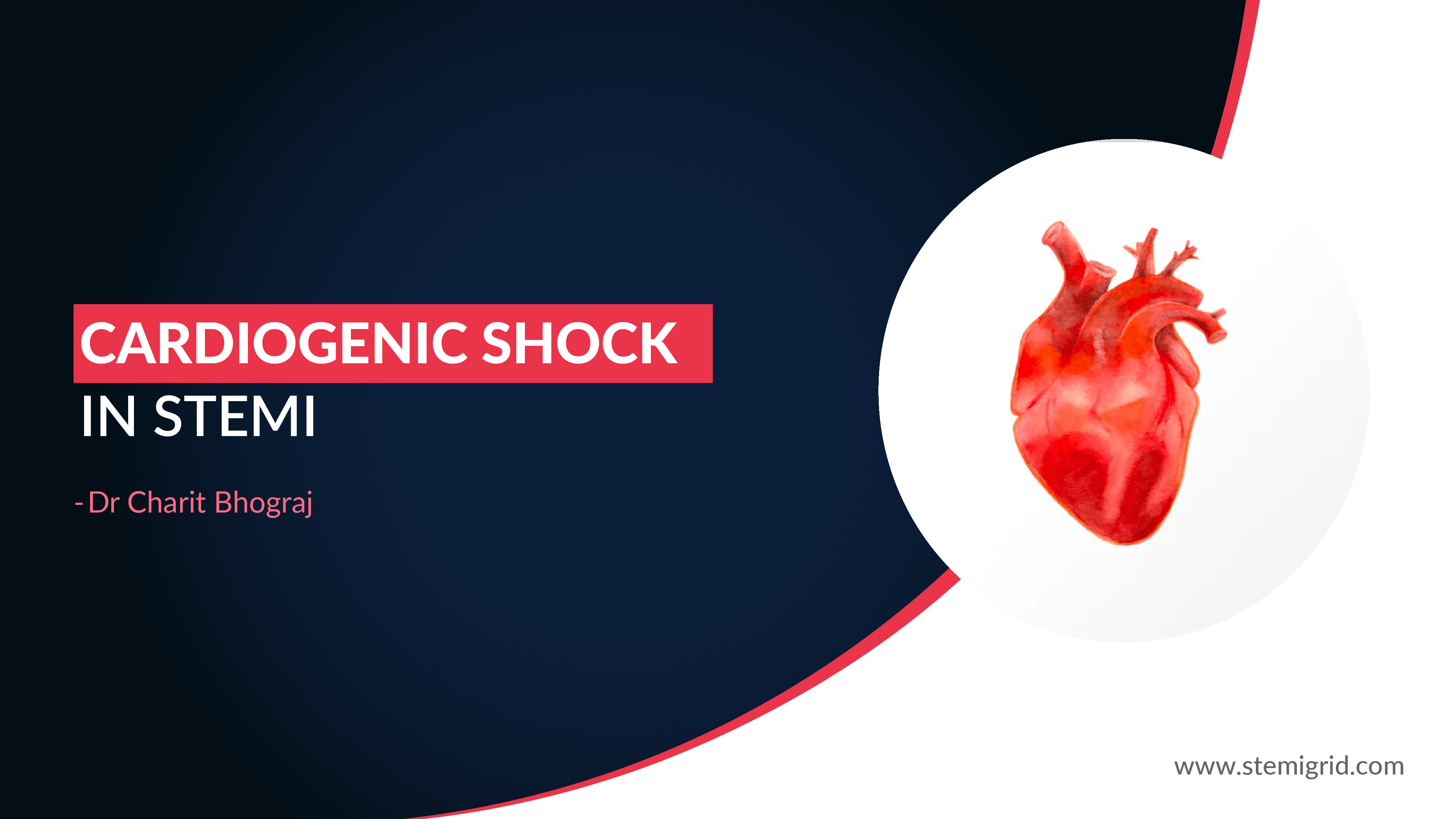 Module 15 Cardiogenic shock StemiGrid